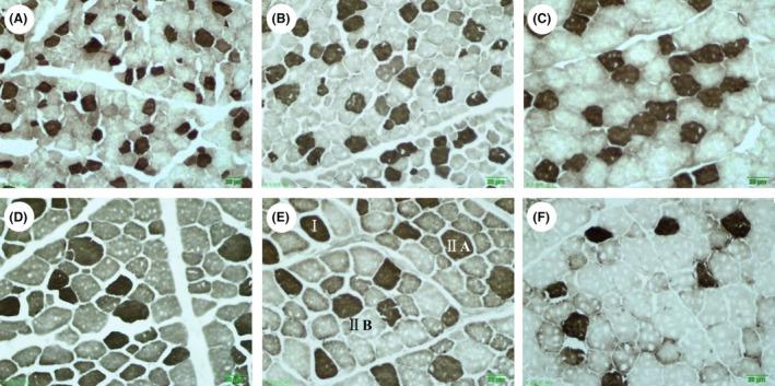 https://cdn.ncbi.nlm.nih.gov/pmc/blobs/f947/5763406/251fc6c0ed43/ASJ-88-2033-g002.jpg