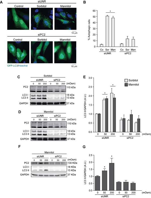 https://cdn.ncbi.nlm.nih.gov/pmc/blobs/f94b/5593539/fb001386457b/oncotarget-08-55984-g003.jpg