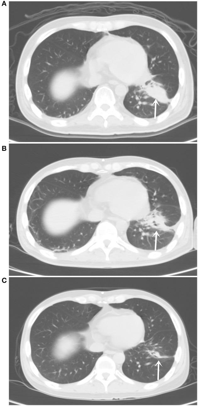 https://cdn.ncbi.nlm.nih.gov/pmc/blobs/f94b/7506151/b1bce2045386/fonc-10-01635-g0001.jpg