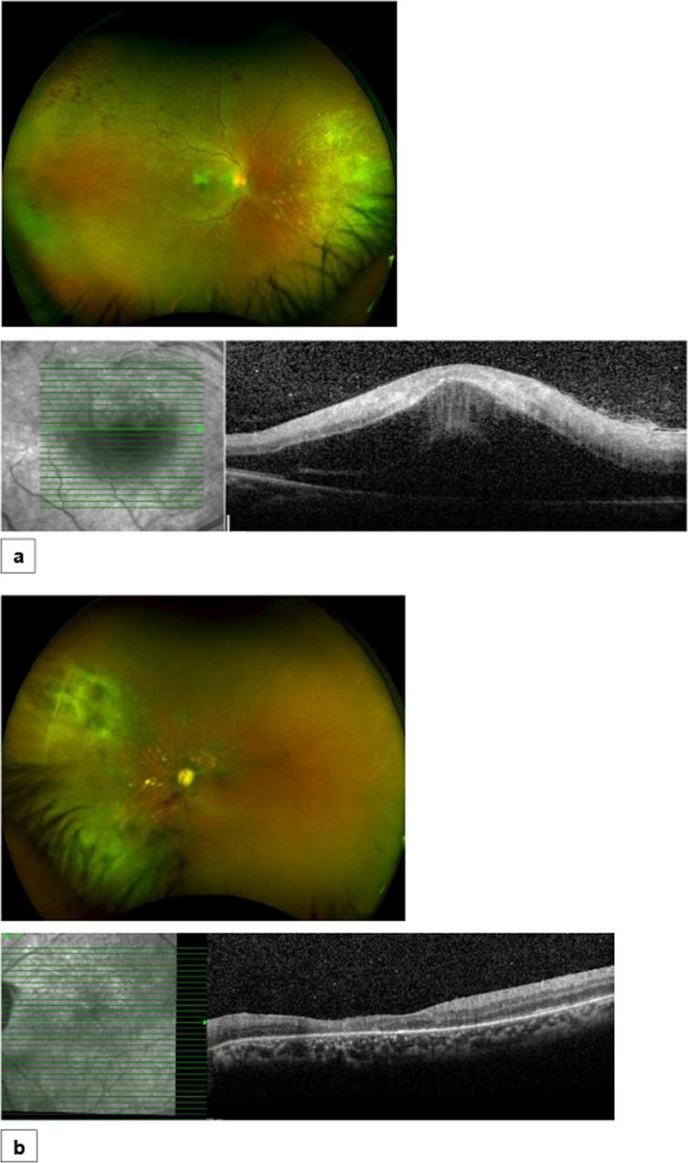 https://cdn.ncbi.nlm.nih.gov/pmc/blobs/f956/10275932/078b76eb9bd0/41433_2022_2267_Fig2_HTML.jpg