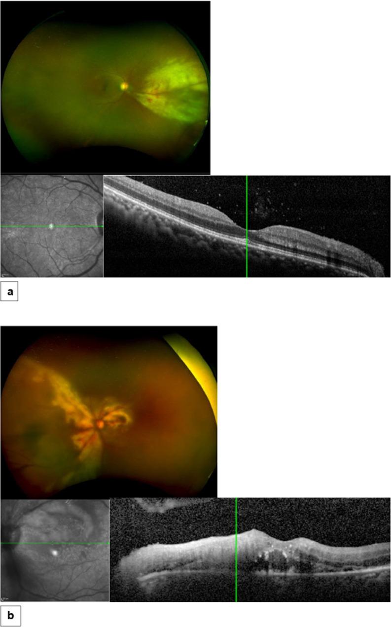 https://cdn.ncbi.nlm.nih.gov/pmc/blobs/f956/10275932/399eb97104d2/41433_2022_2267_Fig1_HTML.jpg