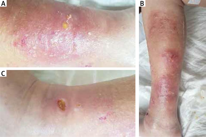 https://cdn.ncbi.nlm.nih.gov/pmc/blobs/f959/9454352/d98207f2e2d1/PDIA-39-47680-g001.jpg