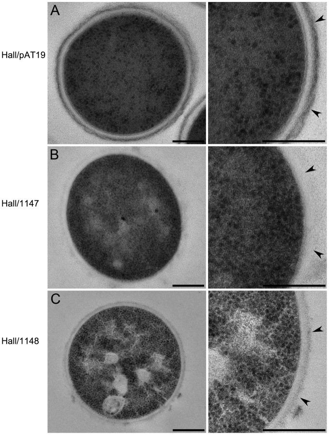 https://cdn.ncbi.nlm.nih.gov/pmc/blobs/f95f/3406050/3435bc381251/pone.0041848.g004.jpg