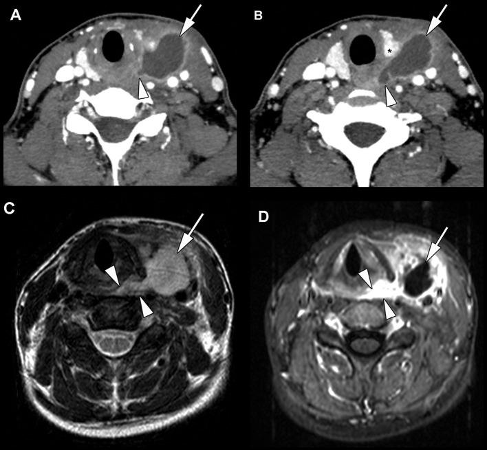 https://cdn.ncbi.nlm.nih.gov/pmc/blobs/f961/8505890/0d3421514cd5/fsurg-08-748351-g0002.jpg