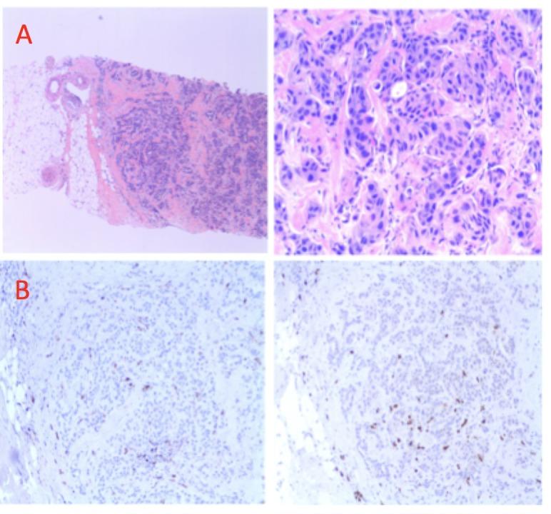 https://cdn.ncbi.nlm.nih.gov/pmc/blobs/f969/5503457/908a6a58e3a4/cureus-0009-00000001332-i02.jpg