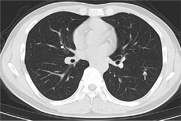 https://cdn.ncbi.nlm.nih.gov/pmc/blobs/f971/7233365/1c096a99c2b0/radiol.2020200432.fig3d.jpg