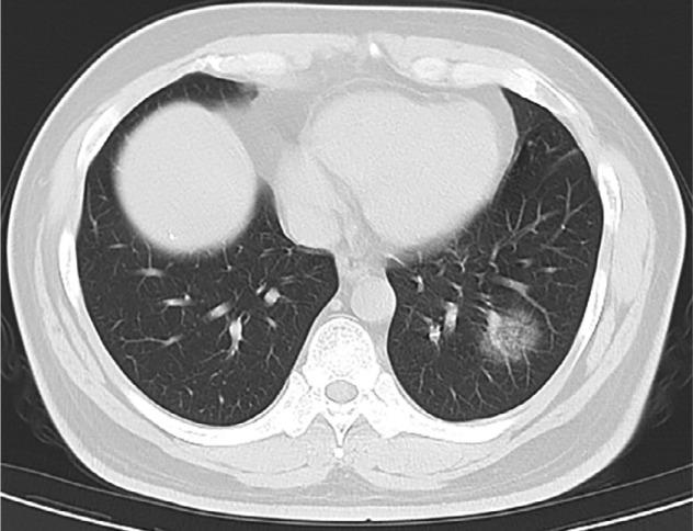 https://cdn.ncbi.nlm.nih.gov/pmc/blobs/f971/7233365/3f971a70d59c/radiol.2020200432.fig3c.jpg
