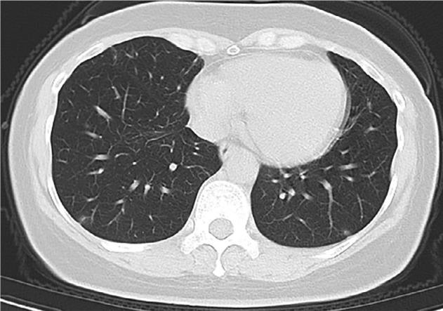 https://cdn.ncbi.nlm.nih.gov/pmc/blobs/f971/7233365/5f1c029499b5/radiol.2020200432.fig3b.jpg