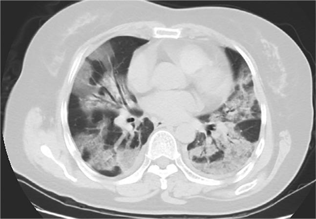 https://cdn.ncbi.nlm.nih.gov/pmc/blobs/f971/7233365/c476dc67a2a9/radiol.2020200432.fig2b.jpg