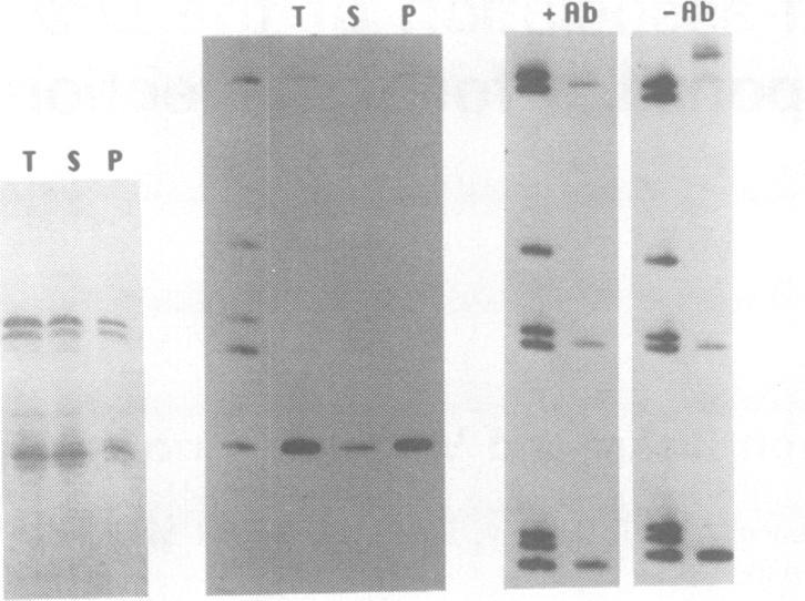 https://cdn.ncbi.nlm.nih.gov/pmc/blobs/f977/552013/c8fbdd2f3f16/emboj00236-0296-a.jpg