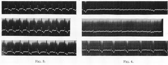 https://cdn.ncbi.nlm.nih.gov/pmc/blobs/f978/480988/cc985387abe0/brheartj00429-0023-b.jpg
