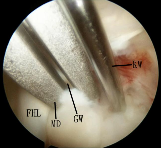 https://cdn.ncbi.nlm.nih.gov/pmc/blobs/f97e/7451441/851d17ced60a/gr6.jpg