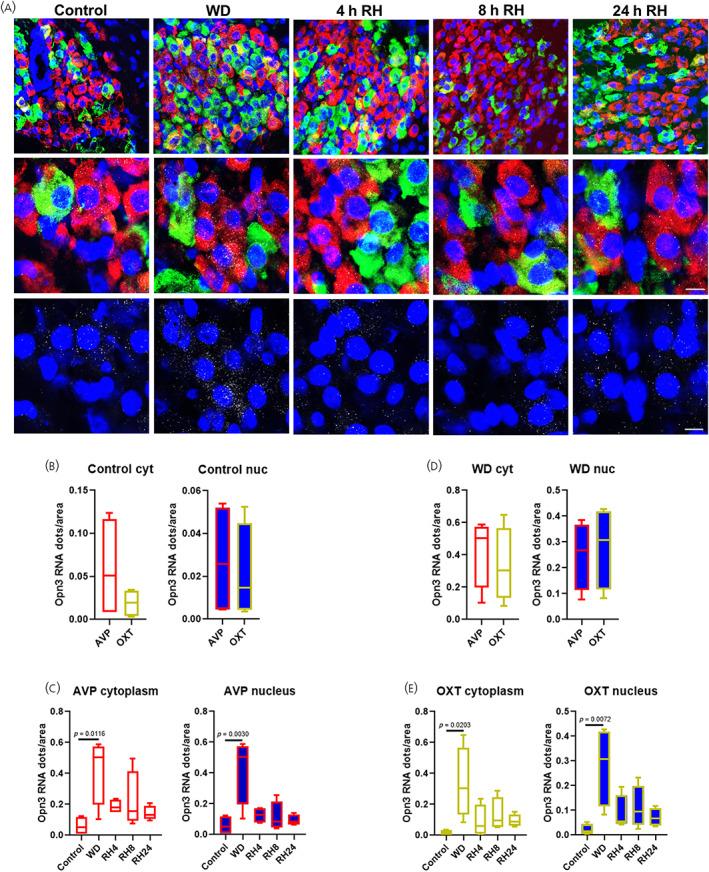 https://cdn.ncbi.nlm.nih.gov/pmc/blobs/f987/11475585/896d7dfc5a9f/JNE-36-e13363-g003.jpg
