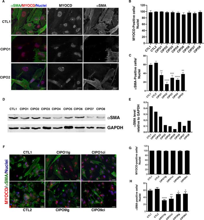 https://cdn.ncbi.nlm.nih.gov/pmc/blobs/f98b/8051695/c4a198e2b7d4/JCMM-25-4028-g006.jpg