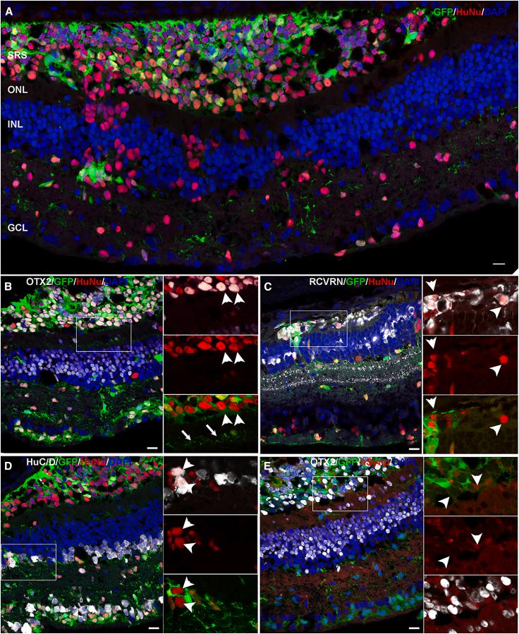 https://cdn.ncbi.nlm.nih.gov/pmc/blobs/f98d/10937153/f33d01244003/gr3.jpg