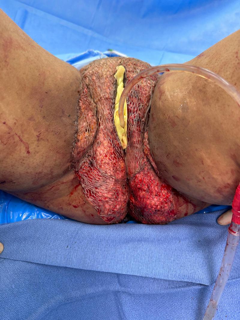 https://cdn.ncbi.nlm.nih.gov/pmc/blobs/f98d/12321450/816a6666d3f7/gox-13-e7040-g003.jpg