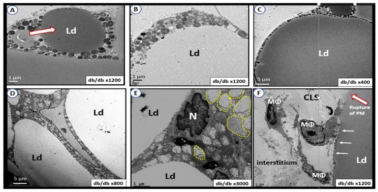 https://cdn.ncbi.nlm.nih.gov/pmc/blobs/f993/9101653/2eb16b3e0f3e/ijms-23-04820-g025.jpg