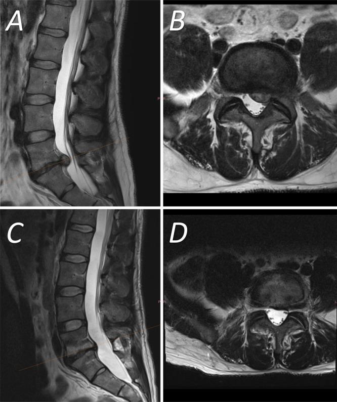 https://cdn.ncbi.nlm.nih.gov/pmc/blobs/f99f/12278955/2e7b4f1dd749/CASE24873_figure_3.jpg