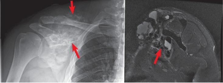 https://cdn.ncbi.nlm.nih.gov/pmc/blobs/f99f/6765162/e83acf80d852/raon-53-275-g008.jpg