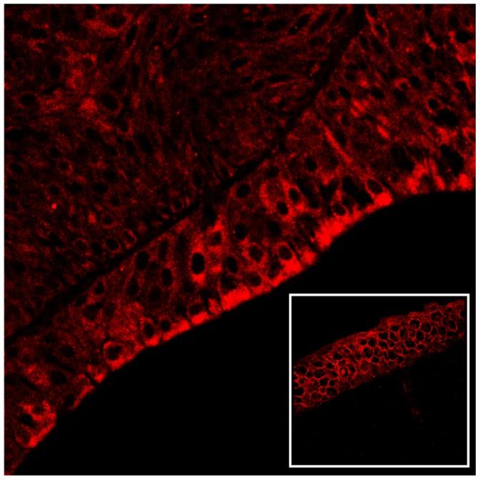 https://cdn.ncbi.nlm.nih.gov/pmc/blobs/f9ab/3933332/06f11eba160a/pone.0088860.g011.jpg