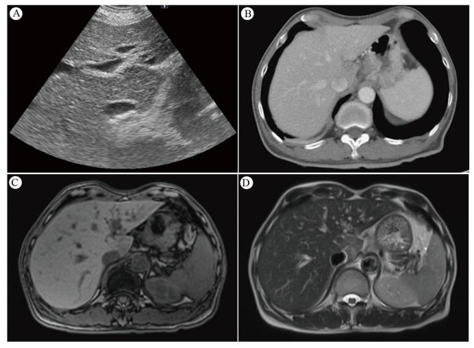 https://cdn.ncbi.nlm.nih.gov/pmc/blobs/f9ac/10931232/185415d9260b/cancers-16-00948-g002.jpg