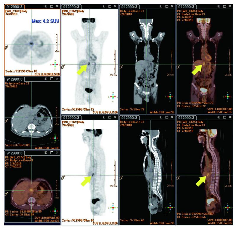 https://cdn.ncbi.nlm.nih.gov/pmc/blobs/f9ac/10931232/6a60cce16c14/cancers-16-00948-g005.jpg