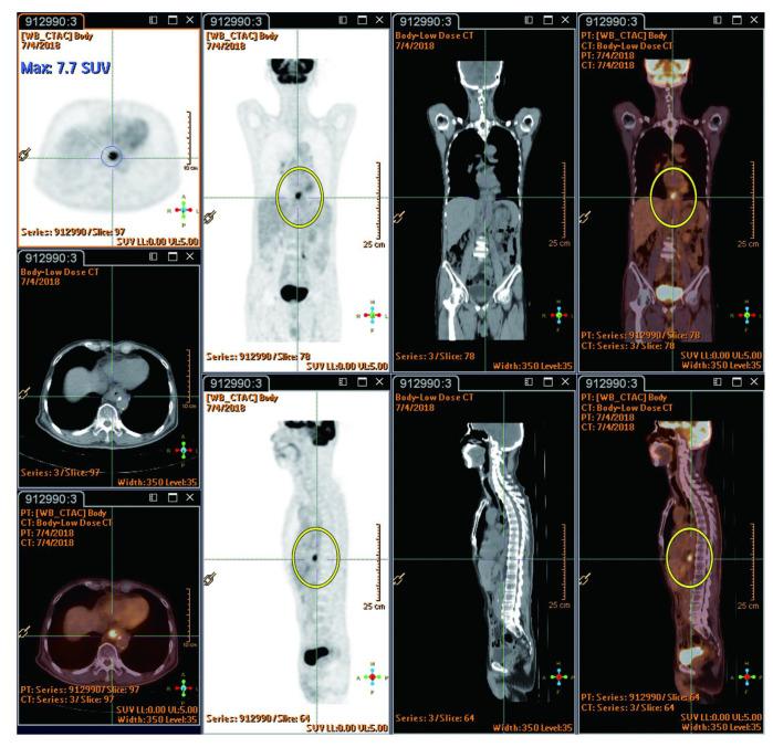 https://cdn.ncbi.nlm.nih.gov/pmc/blobs/f9ac/10931232/8c3b0630ffe6/cancers-16-00948-g004.jpg