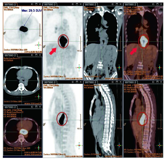 https://cdn.ncbi.nlm.nih.gov/pmc/blobs/f9ac/10931232/8f13472a45e5/cancers-16-00948-g003.jpg