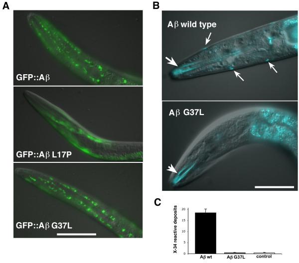 https://cdn.ncbi.nlm.nih.gov/pmc/blobs/f9ad/3178497/7817f3cdef59/1750-1326-6-61-4.jpg