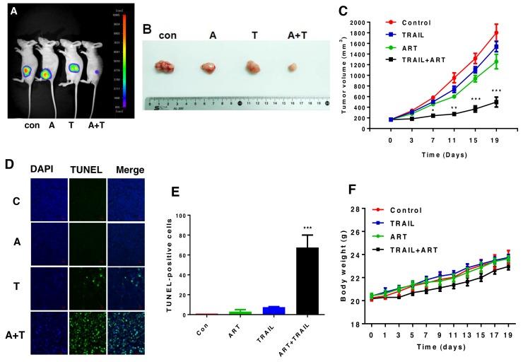 https://cdn.ncbi.nlm.nih.gov/pmc/blobs/f9b3/5777762/56f0170c61c1/oncotarget-08-115164-g008.jpg