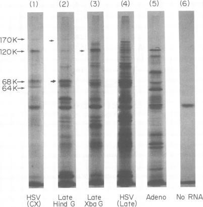 https://cdn.ncbi.nlm.nih.gov/pmc/blobs/f9b7/288666/7bb753246721/jvirol00172-0032-a.jpg