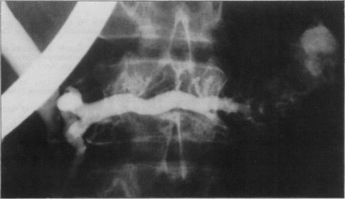 https://cdn.ncbi.nlm.nih.gov/pmc/blobs/f9ba/1432537/c98be20f044a/gut00395-0101-a.jpg