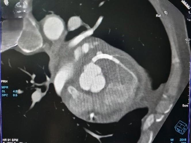 https://cdn.ncbi.nlm.nih.gov/pmc/blobs/f9bb/12198602/ba65745bd128/gr2.jpg
