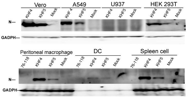 https://cdn.ncbi.nlm.nih.gov/pmc/blobs/f9c3/9607386/2a72ec5ebc9c/viruses-14-02247-g002.jpg