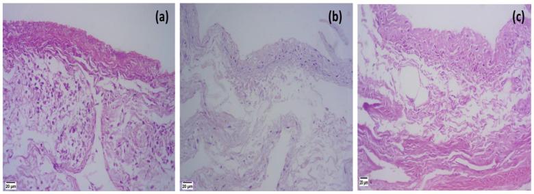 https://cdn.ncbi.nlm.nih.gov/pmc/blobs/f9cd/10675145/44d9082704bf/pharmaceutics-15-02521-g008.jpg