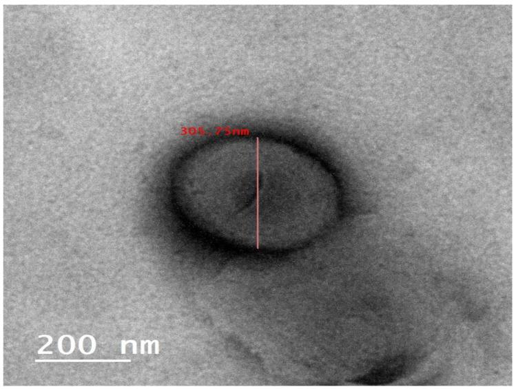 https://cdn.ncbi.nlm.nih.gov/pmc/blobs/f9cd/10675145/b22fae78d84f/pharmaceutics-15-02521-g002.jpg