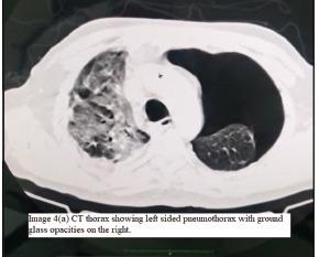 https://cdn.ncbi.nlm.nih.gov/pmc/blobs/f9cf/9648213/4cf740e35492/JFMPC-11-4083-g004.jpg