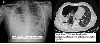 https://cdn.ncbi.nlm.nih.gov/pmc/blobs/f9cf/9648213/bae70cbd3a49/JFMPC-11-4083-g001.jpg