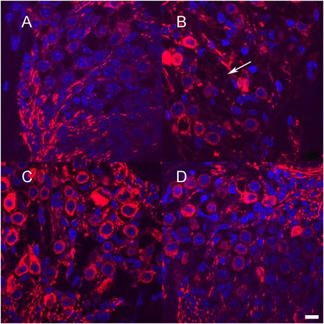 https://cdn.ncbi.nlm.nih.gov/pmc/blobs/f9d1/9204055/a0adeb9d8dee/fbioe-10-892969-g005.jpg
