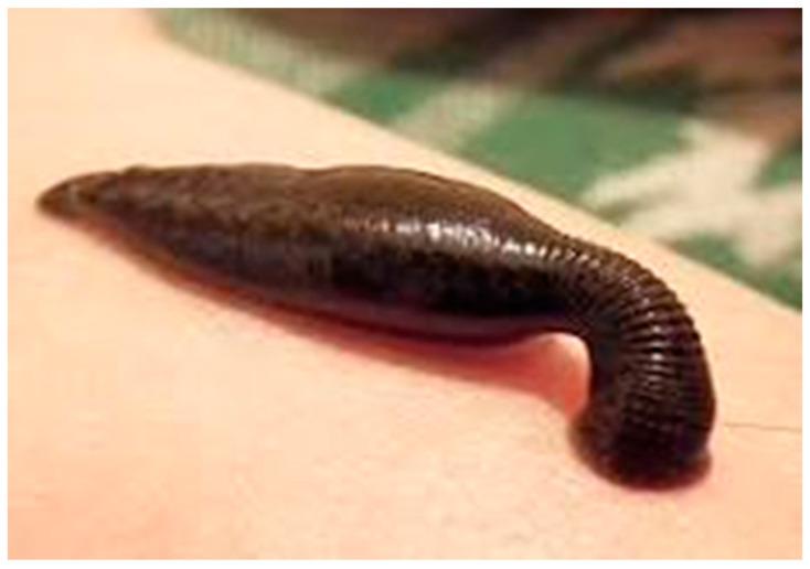 https://cdn.ncbi.nlm.nih.gov/pmc/blobs/f9de/10223966/ab002469fe75/tropicalmed-08-00275-g001.jpg