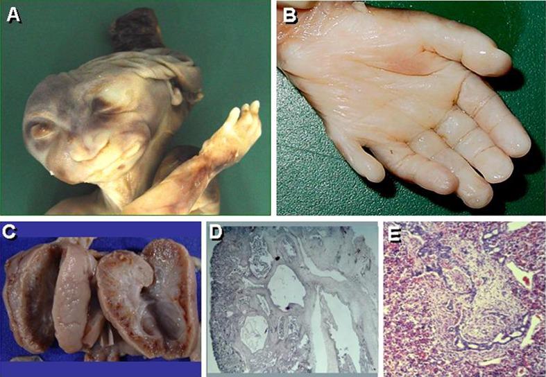 https://cdn.ncbi.nlm.nih.gov/pmc/blobs/f9e5/3419833/e987f140aad4/431_2011_1553_Fig5_HTML.jpg