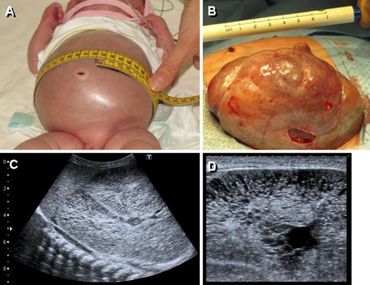 https://cdn.ncbi.nlm.nih.gov/pmc/blobs/f9e5/3419833/f1ae15196597/431_2011_1553_Fig3_HTML.jpg