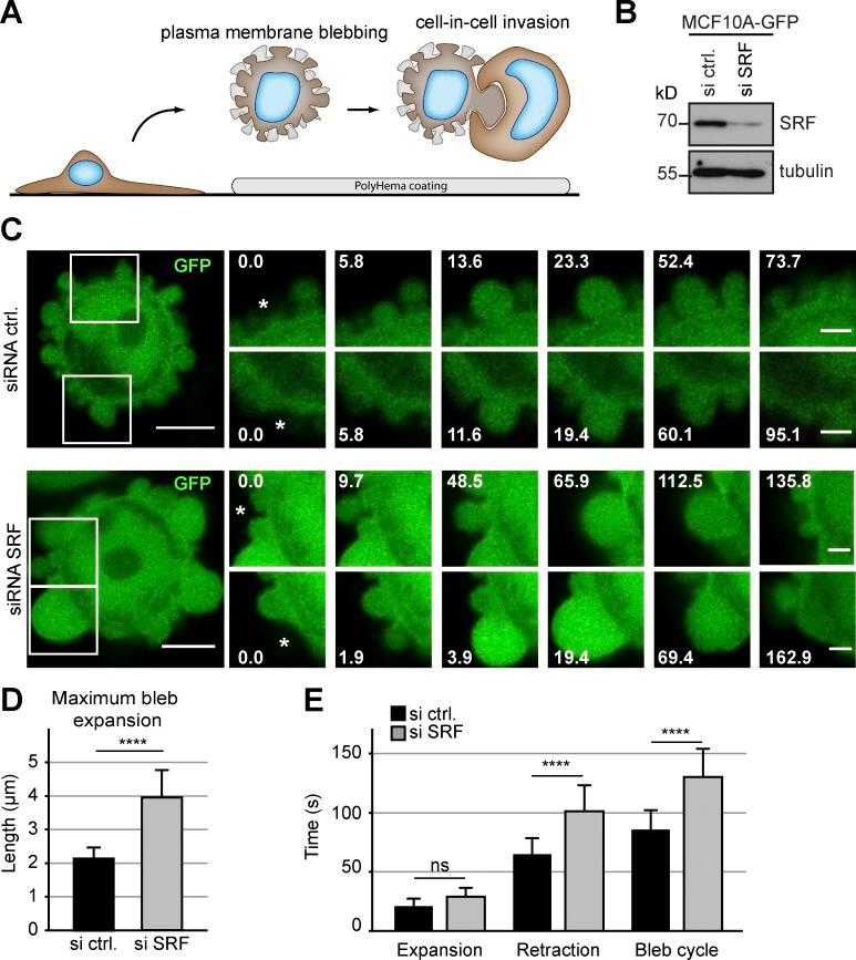 https://cdn.ncbi.nlm.nih.gov/pmc/blobs/f9ef/5626544/35bf7e7290ae/JCB_201702010_Fig1.jpg