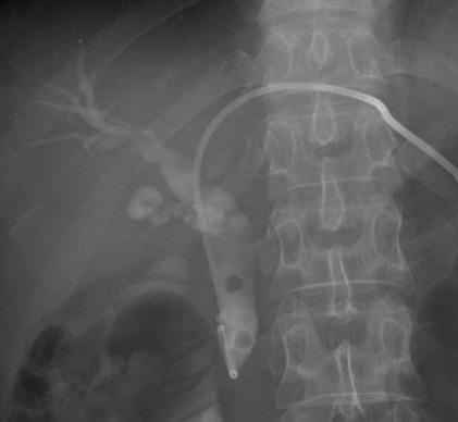 https://cdn.ncbi.nlm.nih.gov/pmc/blobs/f9f7/8943743/bdc62c88f69b/bcr-2021-248285f02.jpg