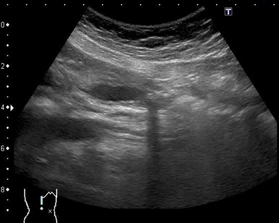 https://cdn.ncbi.nlm.nih.gov/pmc/blobs/f9f7/8943743/e6105d984824/bcr-2021-248285f01.jpg