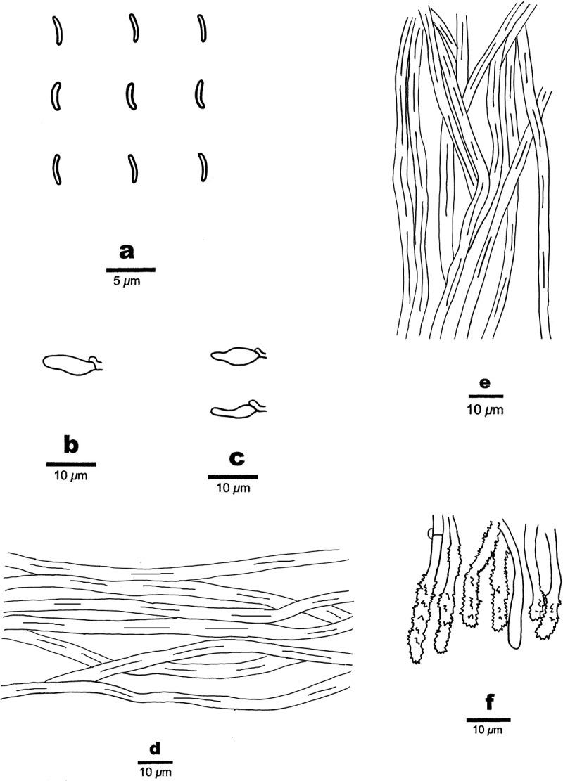 https://cdn.ncbi.nlm.nih.gov/pmc/blobs/f9f8/12422057/e8def034359a/TMYC_A_2448145_F0033_B.jpg