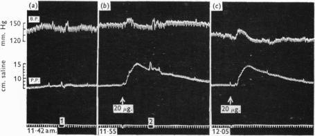 https://cdn.ncbi.nlm.nih.gov/pmc/blobs/f9fa/1392346/15ff111f1110/jphysiol01457-0146-b.jpg