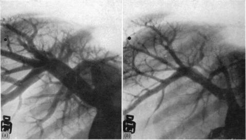 https://cdn.ncbi.nlm.nih.gov/pmc/blobs/f9fa/1392346/dd040e23ea46/jphysiol01457-0144-a.jpg