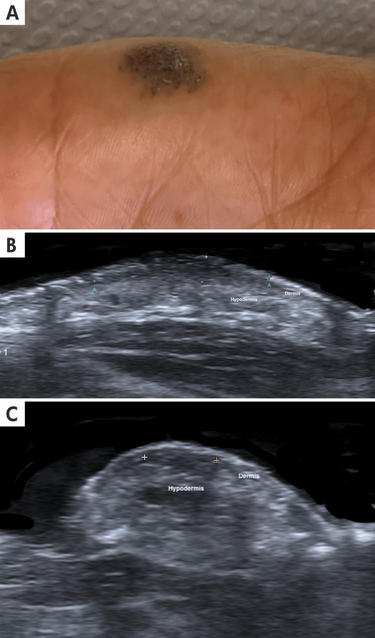 https://cdn.ncbi.nlm.nih.gov/pmc/blobs/fa04/11518829/a8b889df2286/cureus-0016-00000070400-i06.jpg