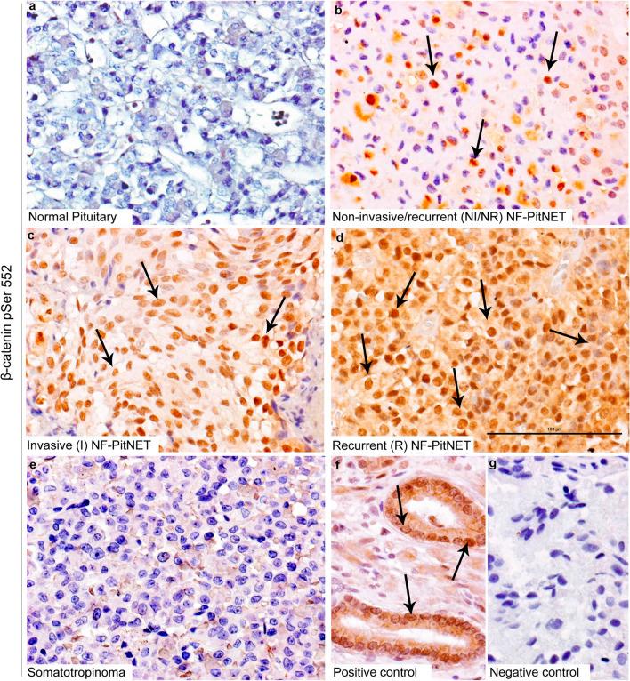 https://cdn.ncbi.nlm.nih.gov/pmc/blobs/fa05/9482208/20cc38b8be4b/40478_2022_1441_Fig4_HTML.jpg